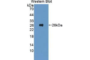 Western blot analysis of the recombinant protein. (FTL anticorps  (AA 5-183))