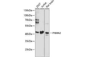 Western blot analysis of extracts of various cell lines, using PNM antibody (ABIN6128525, ABIN6145844, ABIN6145845 and ABIN6220635) at 1:3000 dilution. (PNMA2 anticorps  (AA 1-140))