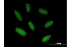 Immunofluorescence of purified MaxPab antibody to ZIM2 on HepG2 cell.