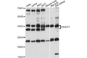 Western blot analysis of extracts of various cell lines, using SUGT1 antibody (ABIN6293563) at 1:1000 dilution. (SUGT1 anticorps)