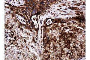 Image no. 4 for anti-Pogo Transposable Element with KRAB Domain (POGK) antibody (ABIN1500329)