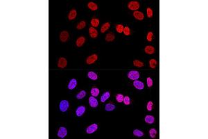 Confocal immunofluorescence analysis of U-2 OS cells using WT1 Polyclonal Antibody (ABIN7271369) at dilution of 1:200. (WT1 anticorps  (AA 1-302))