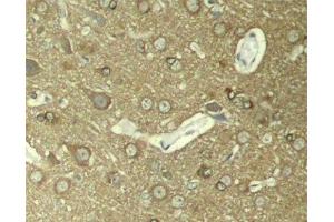 Immunohistochemistry of paraffin-embedded Rat hippocampal region tissue from a model with Alzheimer, using Phospho-Tau(S404) Polyclonal Antibody (tau anticorps  (pSer404))