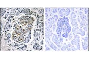 Immunohistochemistry analysis of paraffin-embedded human pancreas tissue, using MtSSB Antibody. (SSBP1 anticorps  (AA 99-148))