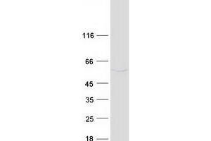 Validation with Western Blot