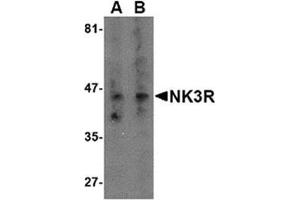 Image no. 1 for anti-Tachykinin Receptor 3 (TACR3) (Middle Region) antibody (ABIN318919) (TACR3 anticorps  (Middle Region))