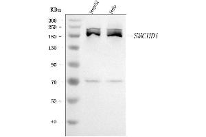 Western blot analysis of SMCHD1 using anti-SMCHD1 antibody (ABIN7602238).