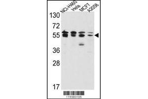 Western blot analysis of IMPDH2 Antibody in NCI-H460,Hela,MCF7,A2058 cell line lysates(35ug/lane)