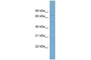 WB Suggested Anti-SLC7A1 Antibody Titration:  0.