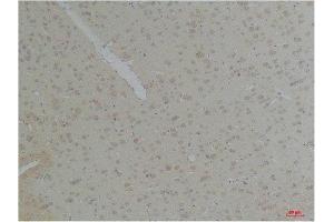 Immunohistochemistry (IHC) analysis of paraffin-embedded Rat Brain Tissue using KCNK10 (TREK-2) Rabbit Polyclonal Antibody diluted at 1:200.