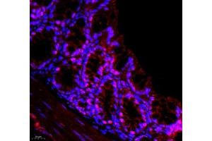 Immunofluorescence of paraffin embedded mouse colon using DMRTA2 (ABIN7073753) at dilution of 1: 650 (400x lens)
