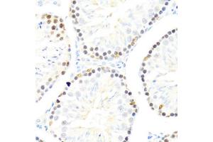 Immunohistochemistry of paraffin-embedded mouse testis using DDX50 antibody (ABIN6129371, ABIN6139509, ABIN6139510 and ABIN6224730) at dilution of 1:100 (40x lens). (DDX50 anticorps  (AA 1-135))