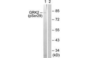 Western blot analysis of extracts from Jurkat cells treated with EGF 200ng/ml 30', using GRK2 (Phospho-Ser29) Antibody. (GRK2 anticorps  (pSer29))