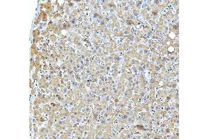 IHC analysis of RANK/TNFRSF11A using anti-RANK/TNFRSF11A antibody (ABIN5518884).