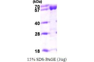 SDS-PAGE (SDS) image for Acyl-CoA Dehydrogenase, Very Long Chain (ACADVL) (AA 41-655) protein (His tag) (ABIN667811)