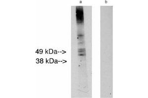 Image no. 1 for anti-Ceramide Synthase 2 (CERS2) antibody (ABIN265217) (Ceramide Synthase 2 anticorps)