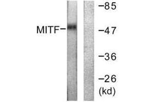 Western blot analysis of extracts from HepG2 cells (lane 1) and COLO205 cells (lane 2), using MITF (Ab-180/73) antibody.