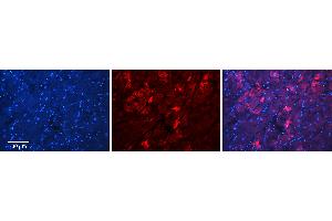 Rabbit Anti-MFN2 Antibody   Formalin Fixed Paraffin Embedded Tissue: Human Heart Tissue Observed Staining: Cytoplasm in cardiomyocytes Primary Antibody Concentration: 1:100 Other Working Concentrations: N/A Secondary Antibody: Donkey anti-Rabbit-Cy3 Secondary Antibody Concentration: 1:200 Magnification: 20X Exposure Time: 0.