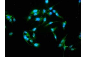 Immunofluorescence staining of Hela cells with ABIN7161797 at 1:155, counter-stained with DAPI.