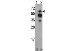 Image no. 1 for anti-tyrosine Kinase, Non-Receptor, 2 (TNK2) (N-Term) antibody (ABIN452711)