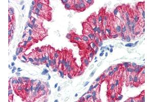 Immunohistochemistry staining of human prostate (paraffin sections) using anti-cytokeratin 8(C-43).