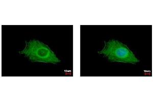 ICC/IF Image FIG4 antibody detects FIG4 protein at cytoplasm by immunofluorescent analysis. (FIG4 anticorps  (Center))