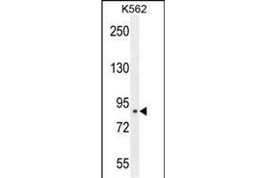 CLIC6 Antibody (Center) (ABIN654431 and ABIN2844167) western blot analysis in K562 cell line lysates (35 μg/lane). (CLIC6 anticorps  (AA 539-565))