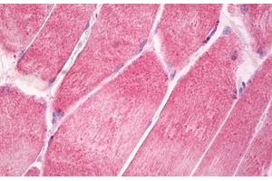 Image no. 2 for anti-Ciliary Neurotrophic Factor Receptor (CNTFR) (AA 295-344) antibody (ABIN6749773)