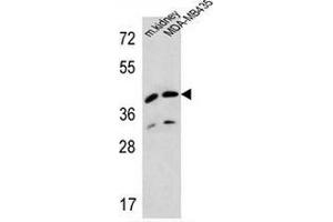 Western blot analysis in MDA-MB435 cell line and mouse kidney tissue lysates (35ug/lane) using L2HGDH/Duranin Antibody . (L2HGDH anticorps  (Middle Region))