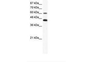 Image no. 1 for anti-Annexin A6 (ANXA6) (AA 28-77) antibody (ABIN203241) (ANXA6 anticorps  (AA 28-77))