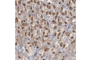 Immunohistochemical staining of human stomach with TBC1D5 polyclonal antibody  shows moderate cytoplasmic positivity in parietal cells. (TBC1D5 anticorps)
