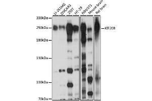 Western blot analysis of extracts of various cell lines, using KIF20B antibody.