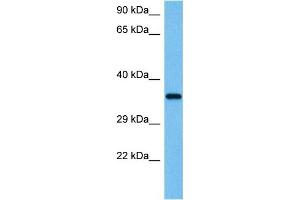 Host:  Mouse  Target Name:  WNT4  Sample Tissue:  Mouse Testis  Antibody Dilution:  1ug/ml (WNT4 anticorps  (Middle Region))