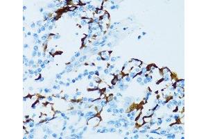 Immunohistochemistry of paraffin-embedded Human tonsil using CTSE Polyclonal Antibody at dilution of 1:100 (40x lens). (Cathepsin E anticorps)