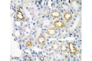 Immunohistochemistry of paraffin-embedded Rat kidney using RARRES2 Polyclonal Antibody at dilution of 1:200 (40x lens). (Chemerin anticorps)