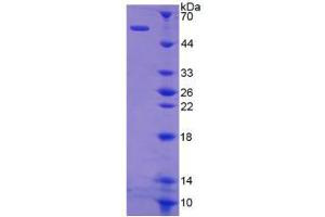 Image no. 1 for Kallikrein 1 (KLK1) (AA 27-261) protein (His tag,GST tag) (ABIN4988566) (Kallikrein 1 Protein (KLK1) (AA 27-261) (His tag,GST tag))