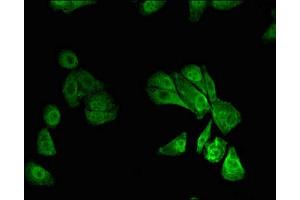 Immunofluorescent analysis of HepG2 cells using ABIN7168481 at dilution of 1:100 and Alexa Fluor 488-congugated AffiniPure Goat Anti-Rabbit IgG(H+L)