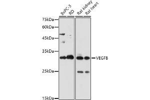 Western blot analysis of extracts of various cell lines, using VEGFB antibody (ABIN7271298) at 1:1000 dilution.