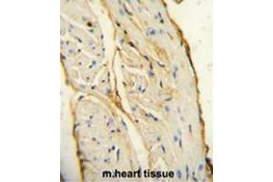 AIF1 antibody (N-term) immunohistochemistry analysis in formalin fixed and paraffin embedded mouse heart tissue followed by peroxidase conjugation of the secondary antibody and DAB staining. (Iba1 anticorps  (N-Term))