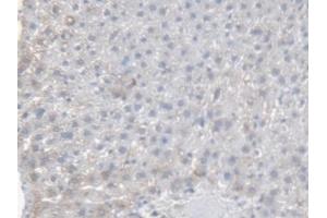 Detection of CES1 in Rat Liver Tissue using Polyclonal Antibody to Carboxylesterase 1 (CES1)
