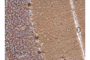 IHC-P Image Aldolase A antibody detects Aldolase A protein at cytosol on rat hind brain by immunohistochemical analysis.