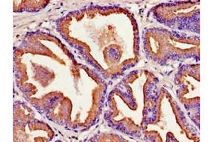 Immunohistochemistry of paraffin-embedded human prostate tissue using ABIN7157208 at dilution of 1:100 (Kallikrein 2 anticorps  (AA 25-261))