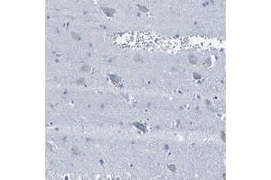 Immunohistochemical staining of human lateral ventricle with BFSP2 polyclonal antibody  shows weak cytoplasmic positivity in neuronal cells. (BFSP2 anticorps)