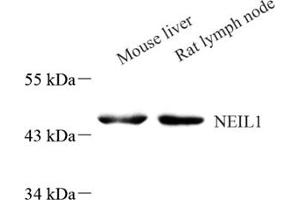 Western blot analysis of Neil1 (ABIN7073820) at dilution of 1: 800 (NEIL1 anticorps)