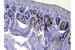IHC analysis of EGF using anti-EGF antibody .