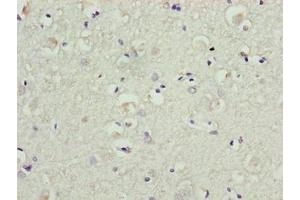 Immunohistochemistry of paraffin-embedded human brain tissue using ABIN7145267 at dilution of 1:100 (BATF2 anticorps  (AA 1-189))
