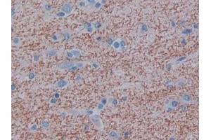 Detection of MAG in Human Cerebrum Tissue using Polyclonal Antibody to Myelin Associated Glycoprotein (MAG)