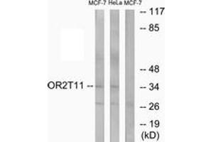 Western blot analysis of extracts from MCF-7/HeLa cells, using OR2T11 Antibody.