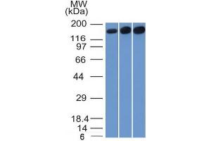 Western Blot of HepG2, HeLa and 3T3 cell lysate using Topo II alpha, Monoclonal Antibody (TOP2A/1361).