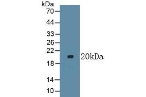 Detection of Recombinant LTbR, Human using Monoclonal Antibody to Lymphotoxin Beta Receptor (LTbR)